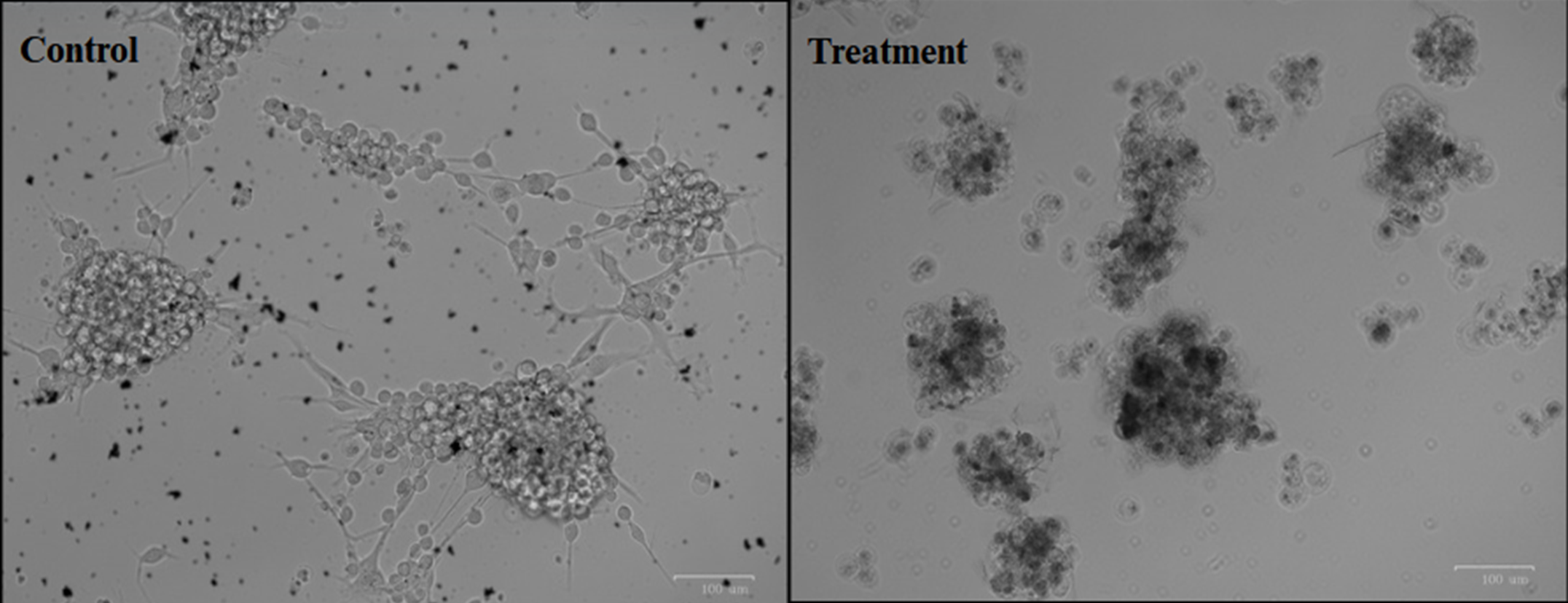 Glioblastoma brain cancer cells under normal conditions (left) vs. after treatment with Lion’s Mane mushroom secretions (right). These clumped, opaque cells are undergoing apoptosis—evidence that the secretions are triggering brain cancer cell death.