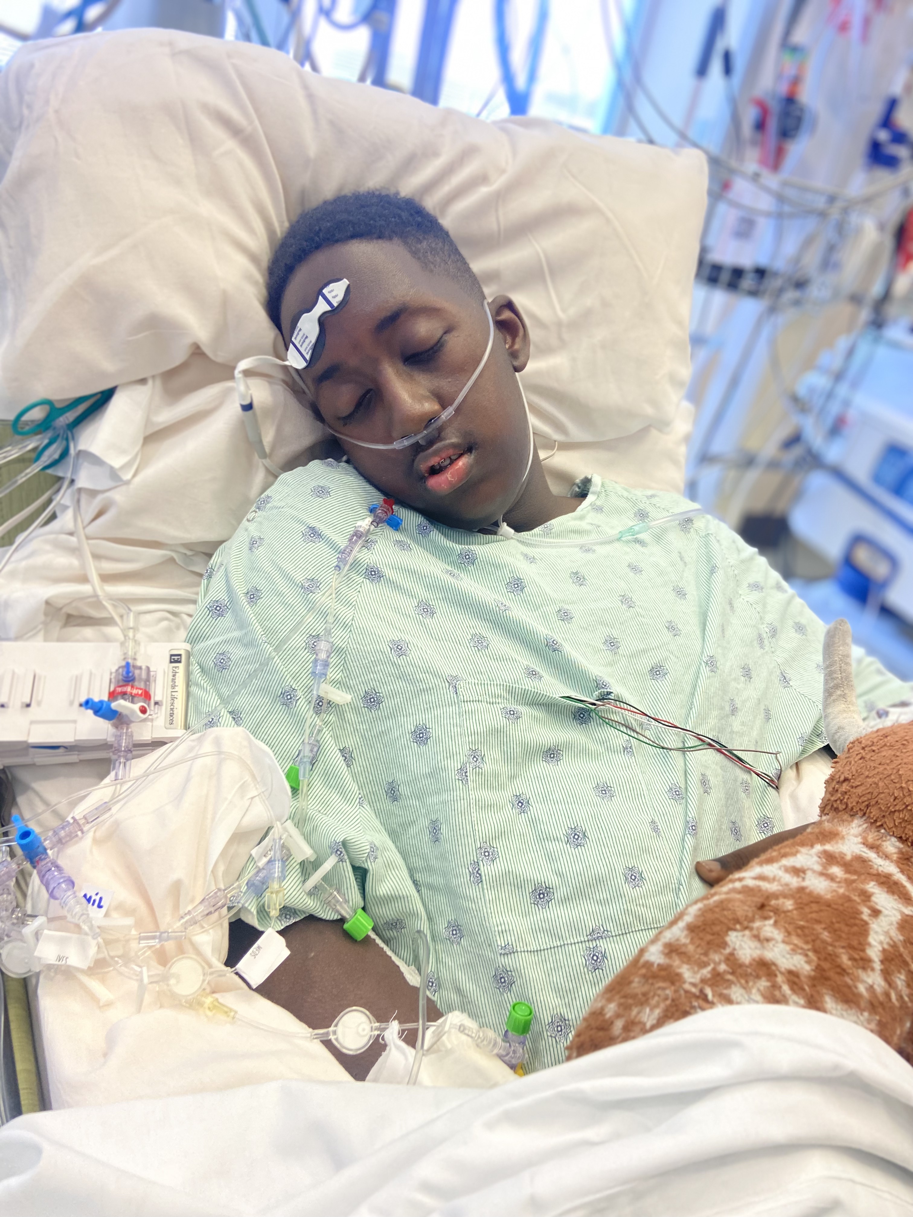 Young teen asleep in a hospital bed