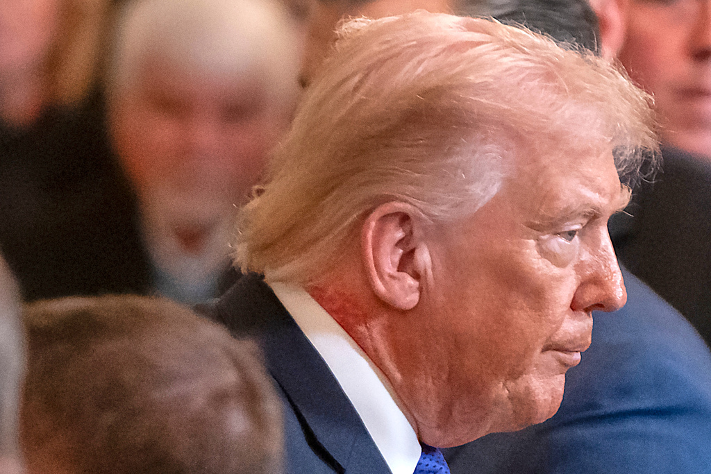 Trump: The redness drew widespread attention Monday, when news photographers captured close-up images of the president
