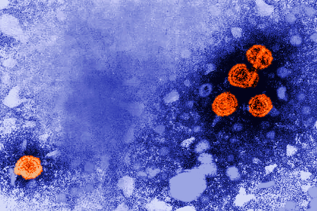 An Experimental Hepatitis B Drug Might Offer 'Functional Cure'