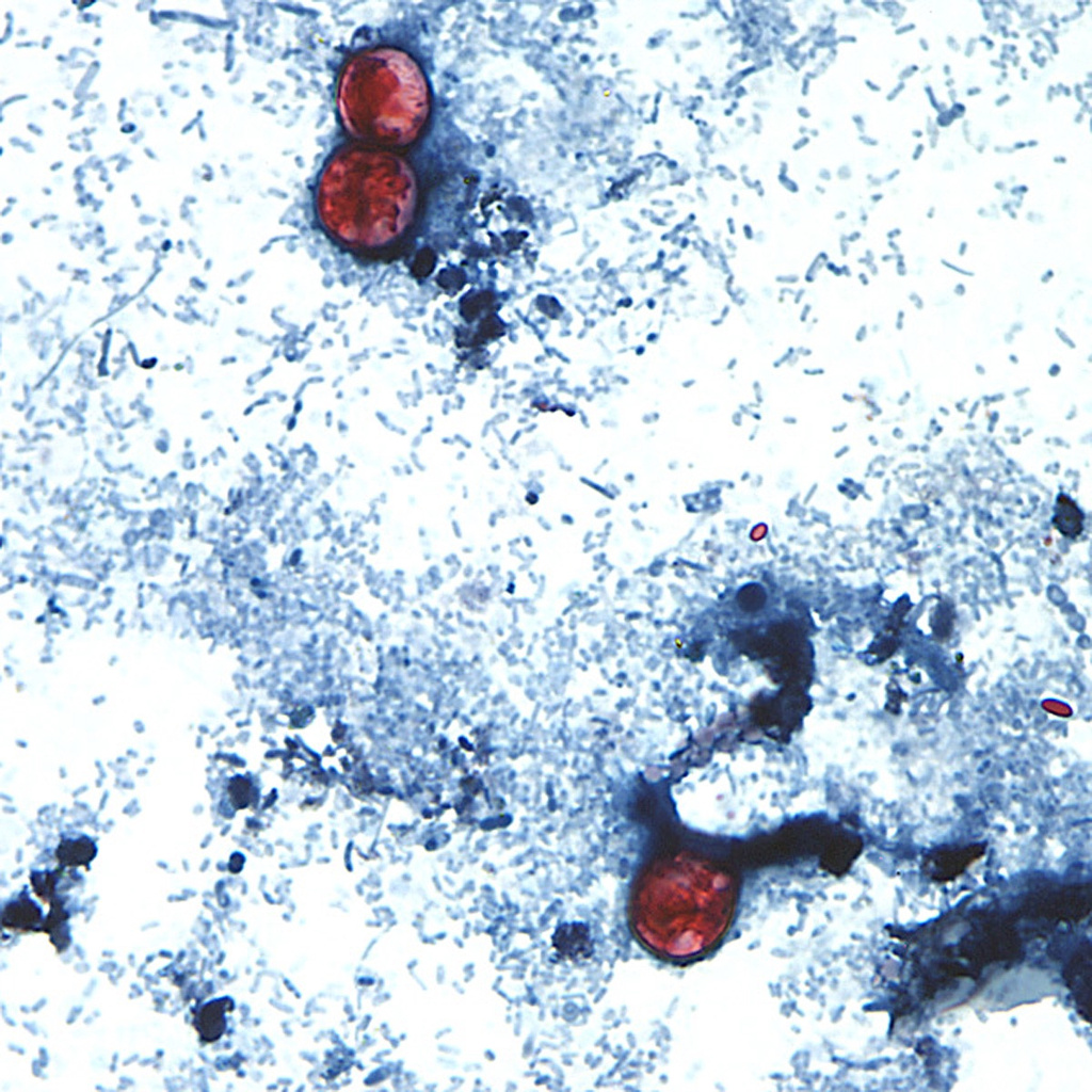 Cyclospora cayetanensis oocysts