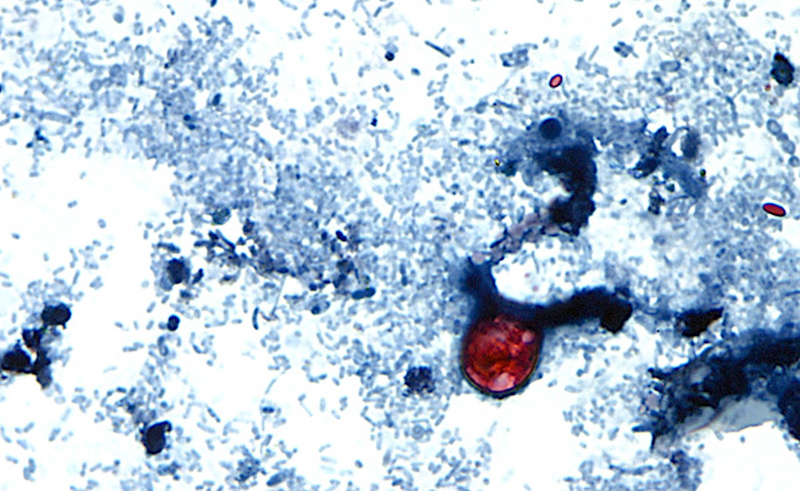 Cyclospora: New Outbreak Of Diarrhea-Causing Parasite