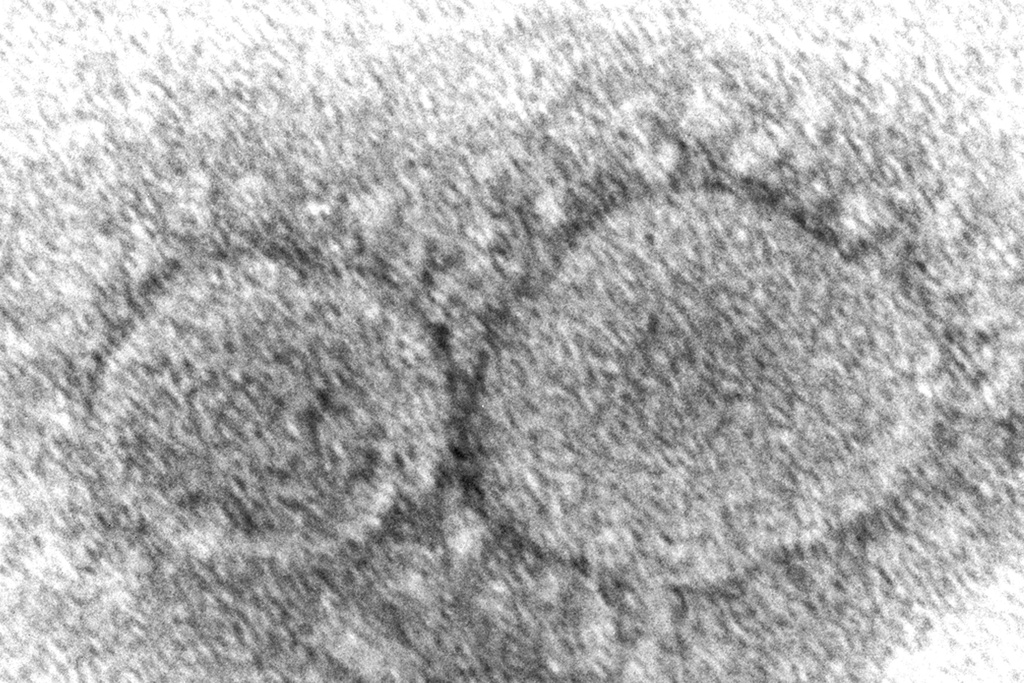 Electron microscope image made available by the Centers for Disease Control and Prevention shows SARS-CoV-2 virus particles, which cause COVID-19.