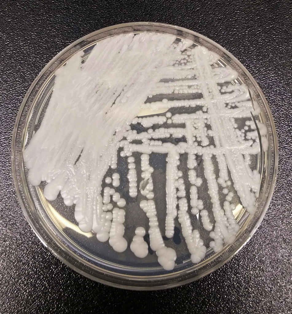 A strain of Candida auris cultured in a petri dish at a CDC laboratory