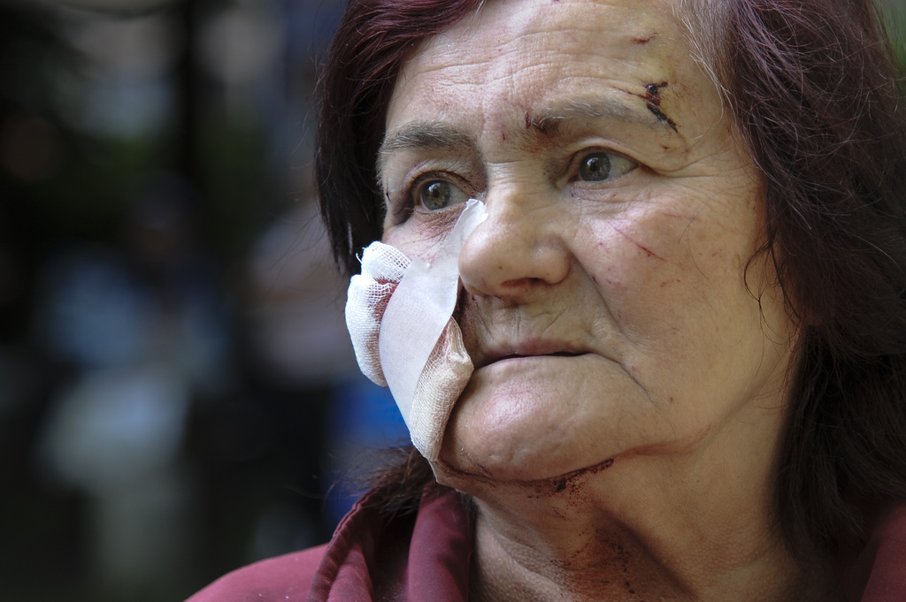 Hanna Fedorenko speaks to journalists after being injured in a Russian missile attack in Lviv
