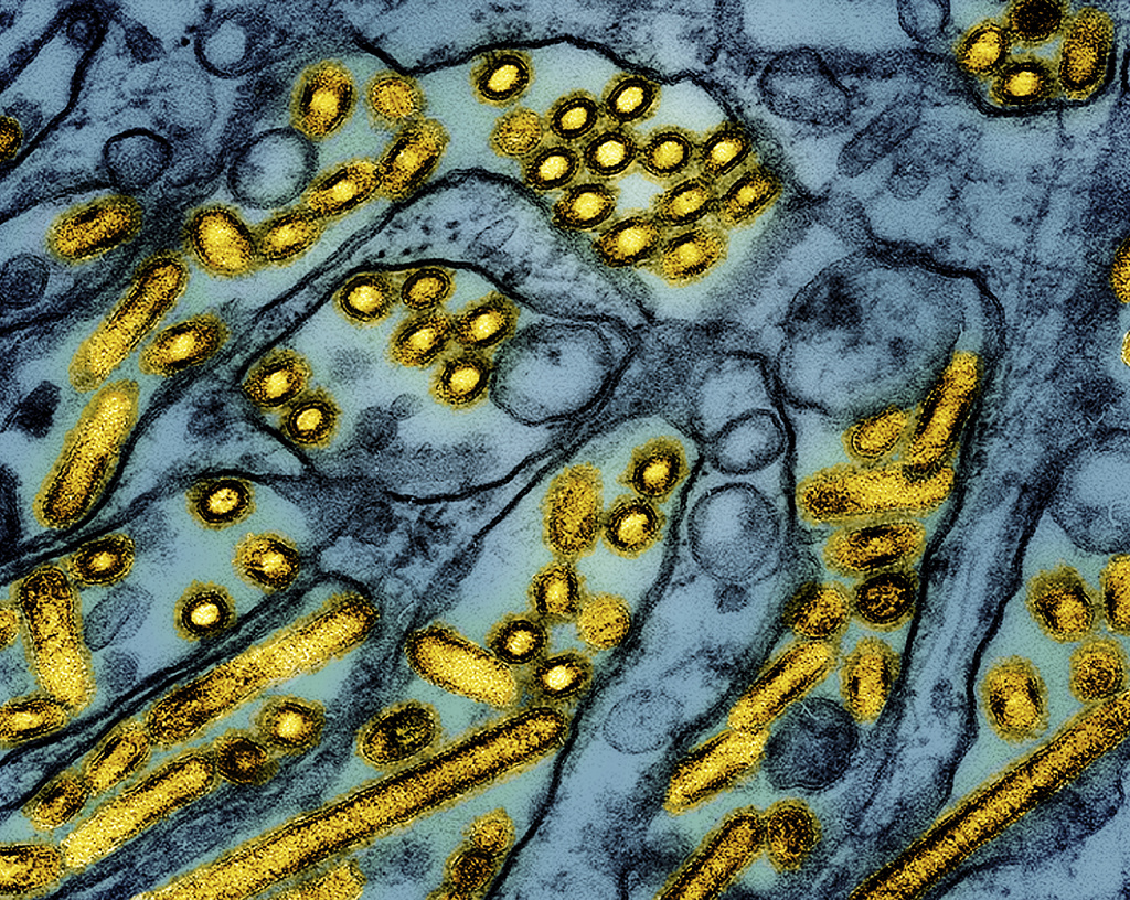The First Confirmed Bird Flu Infection in A US Child Is A California ...